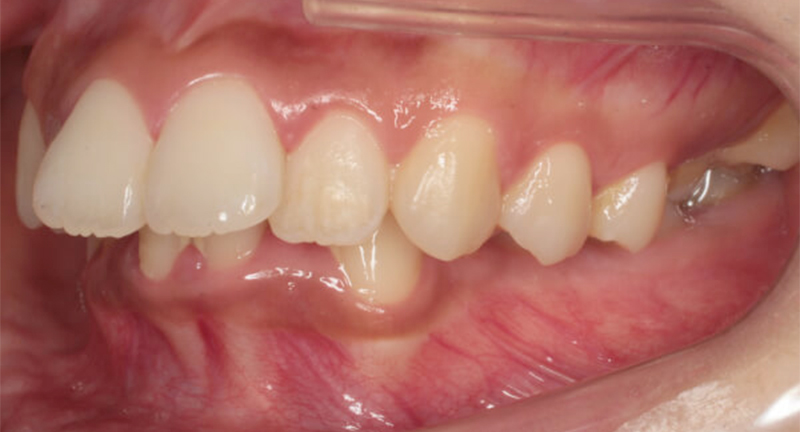歯並びでこのようなお悩みはありませんか？