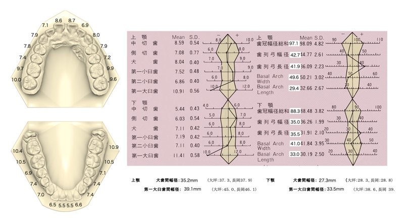 模型分析